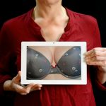 Breast Plastic Surgery