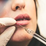 botox,woman holding pen and white cotton candy